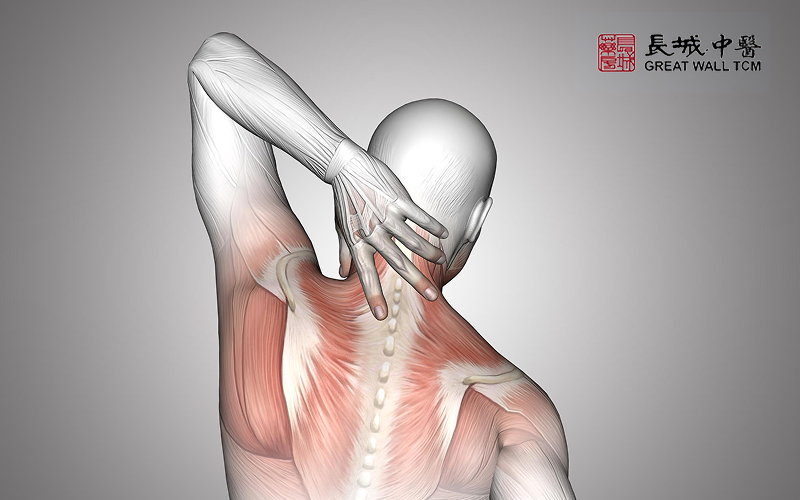 A diagram illustrating muscle strain from tech neck.